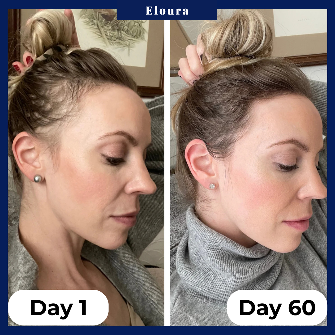 Hair Growth Serum Roll