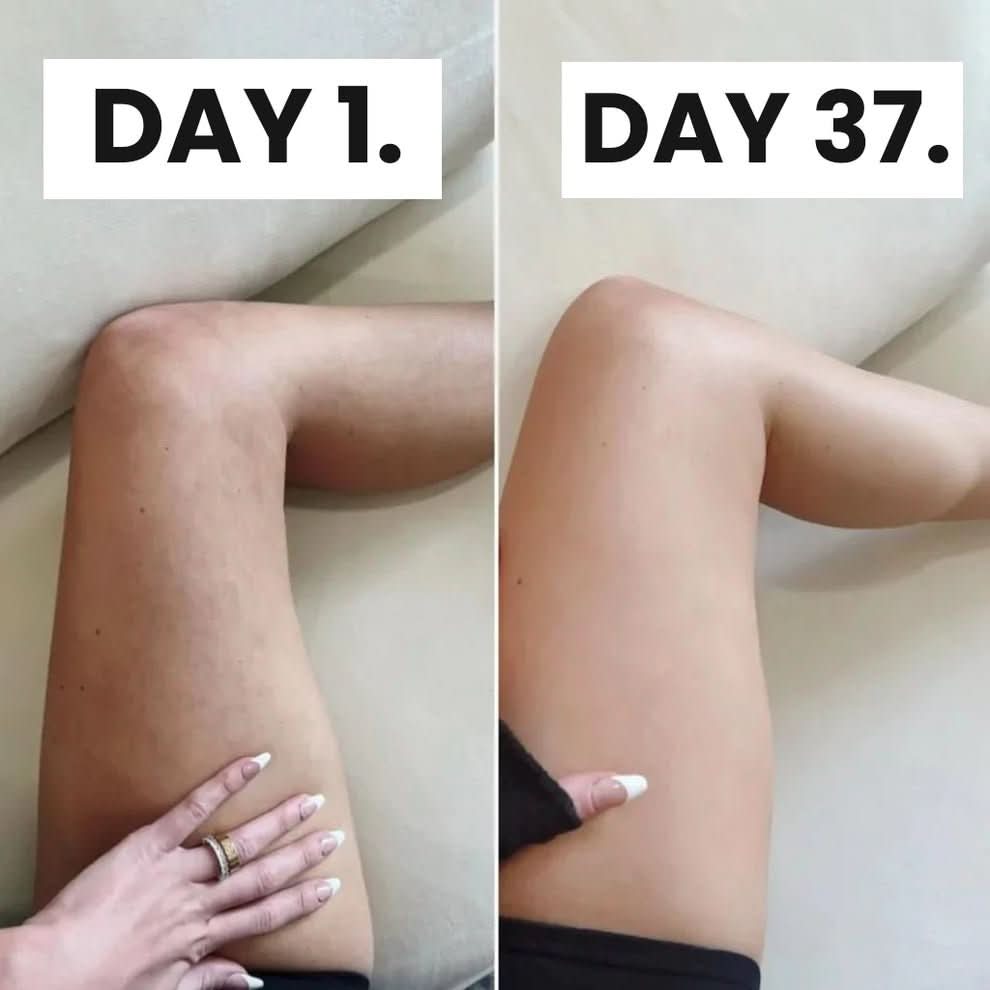 Lunara Cellulite Relief Kit