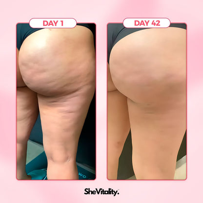 Lunara Cellulite Relief Kit